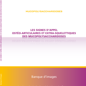 Les signes d'appel ostéo-articulaires & extra-squelettiques des mucopolysaccharidoses