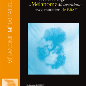 Prise en charge du mélanome métastatique avec mutation de Braf