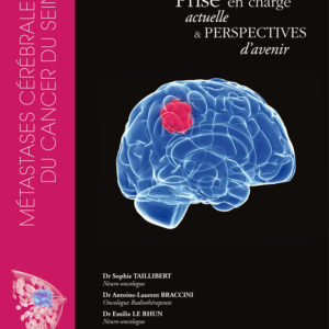 Métastases cérébrales du cancer du sein : prise en charge actuelle & perspectives d'avenir