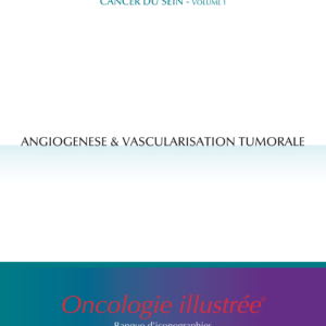 Cancer du sein - volume 1 : Angiogénèse & vascularisation tumorale