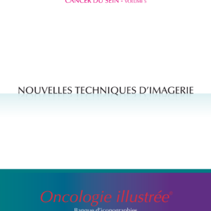 Cancer du sein - volume 5 : Nouvelles techniques d'imagerie